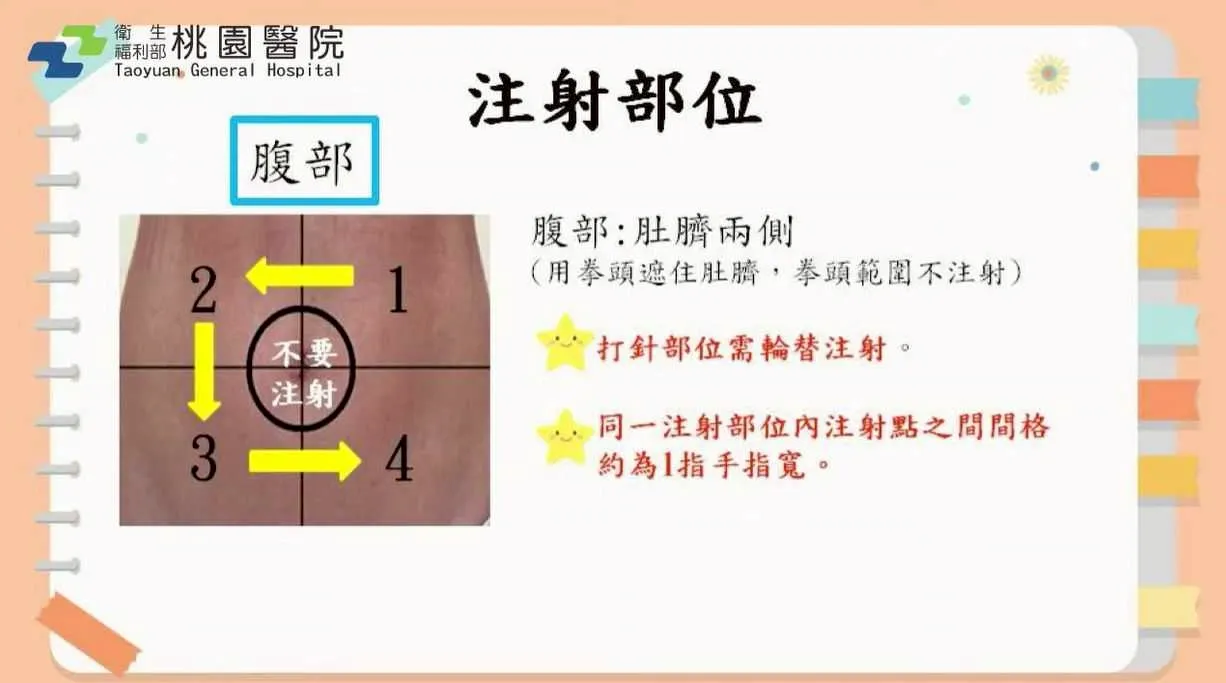 注射示意圖 1