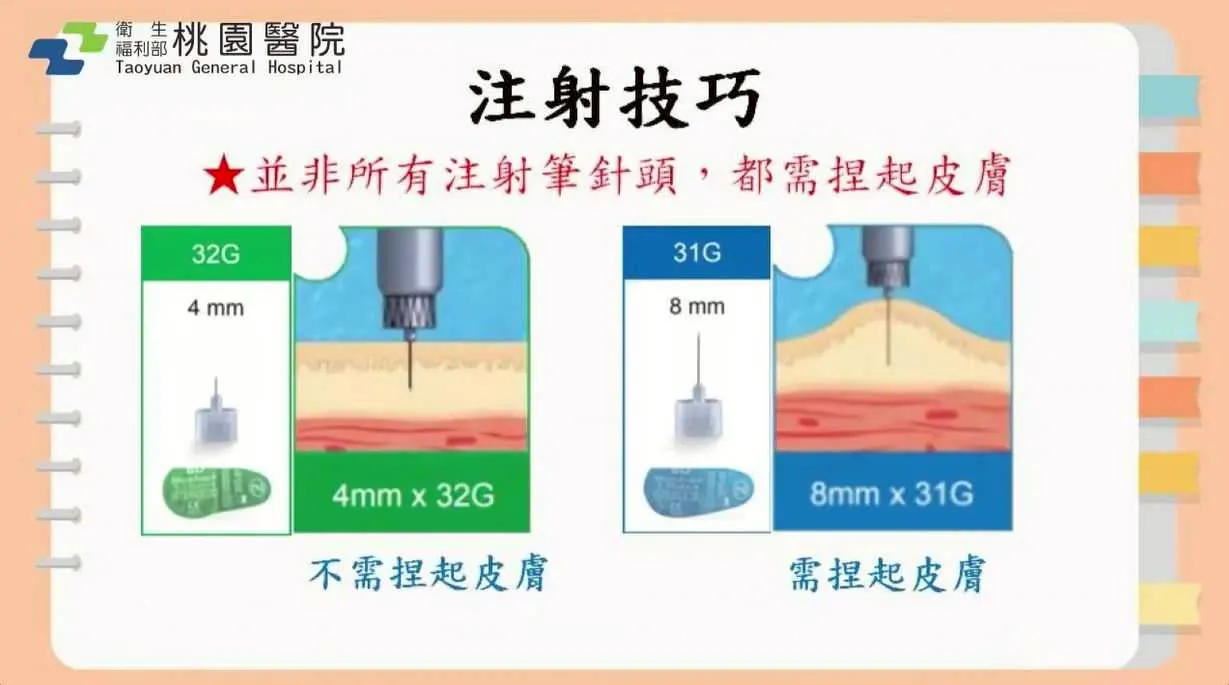 注射示意圖 3